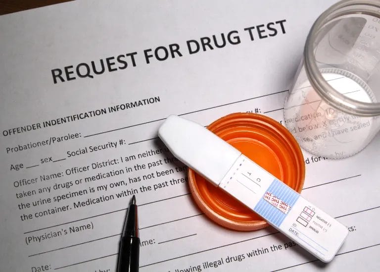 Do Mushrooms Show Up On a Drug Test