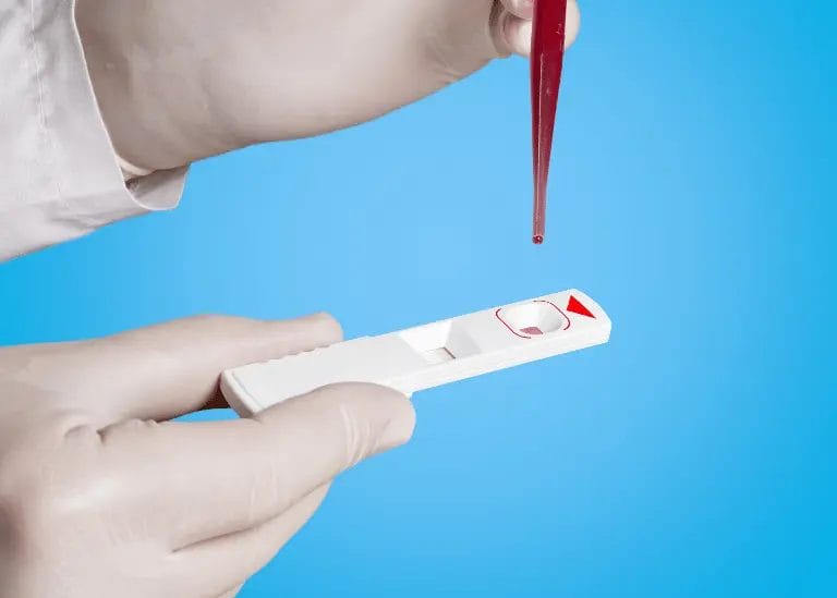 are Mushrooms Detectable by a Drug Test